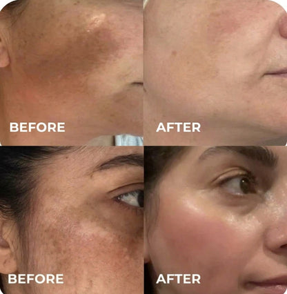 Korean Arbutin + TXA Cream
